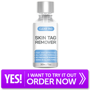 Clear Tag Skin Tag Remover